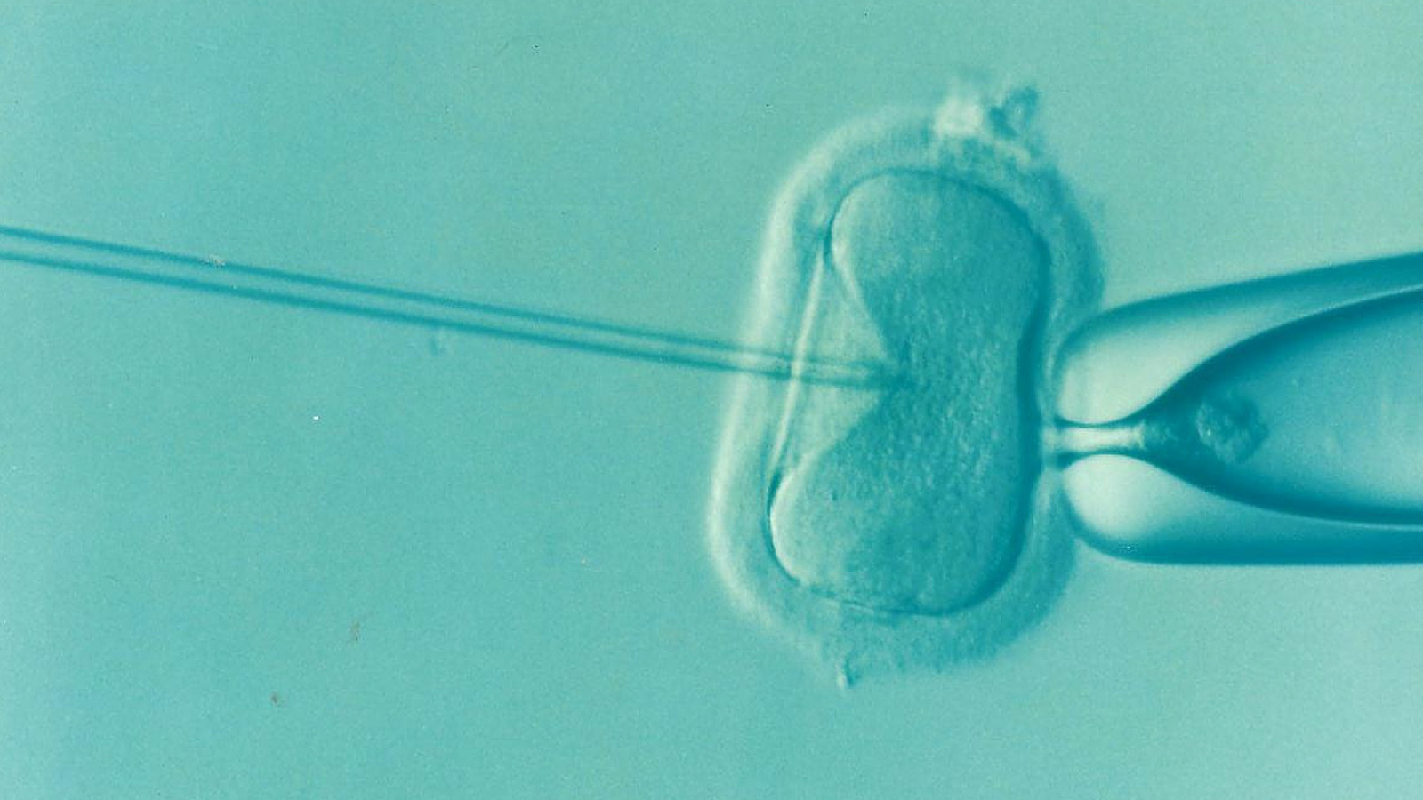 Ma position exprimée sur le projet de loi bioéthique lors de la discussion générale du texte
